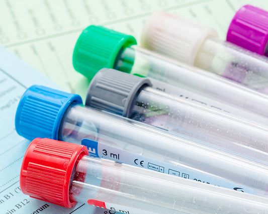 Saliva Hormone Testing